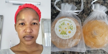Earth as a pharmacy: Dlamini builds backyard dandelion brand